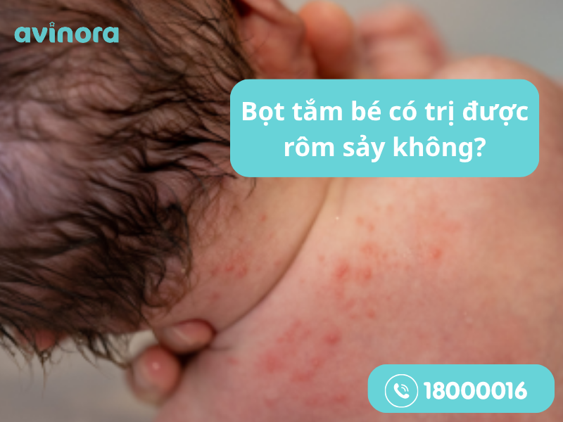 Bọt tắm bé có trị rôm sảy không?